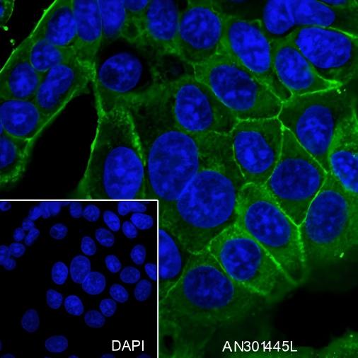 Recombinant beta-2 Adrenergic Receptor Monoclonal Antibody - small - 4