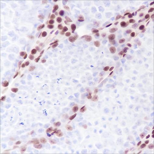 Recombinant Androgen Receptor (CT) Monoclonal Antibody - small - 4