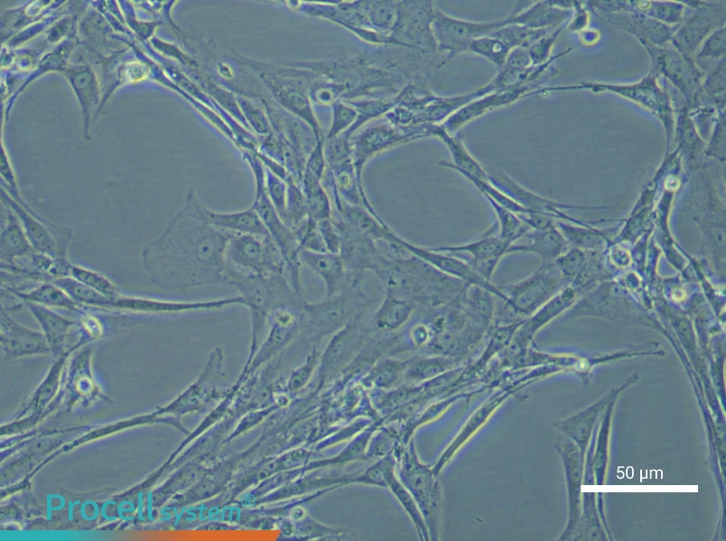 Rat Pulmonary Artery Smooth Muscle Cell Complete Medium - 6