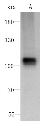 Recombinant ACE2 Monoclonal Antibody - small - 2