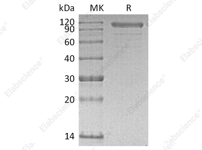 Recombinant Human Cadherin-6/CDH6 Protein (His Tag) - 1