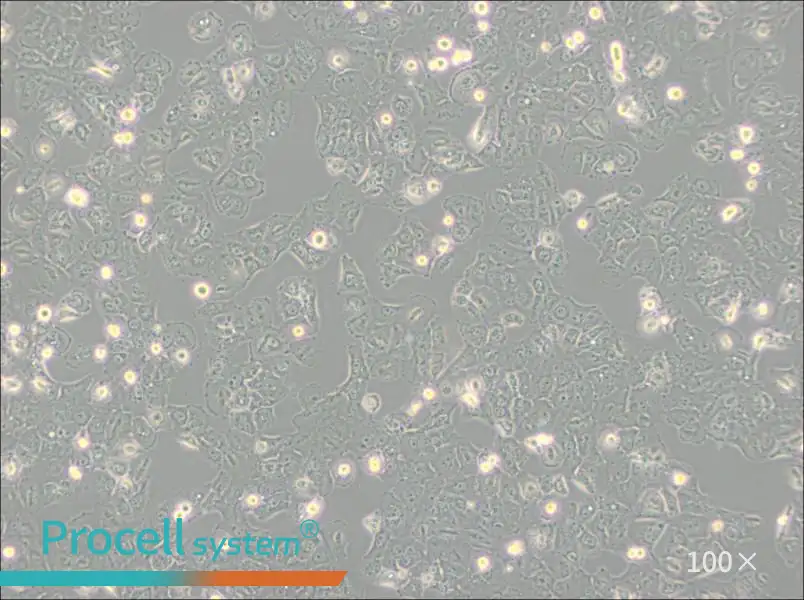 Caov-3 Cell Complete MediumCaov-3 Cell Complete Medium - 3