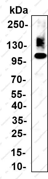 Recombinant YTHDC1 Monoclonal Antibody - 3