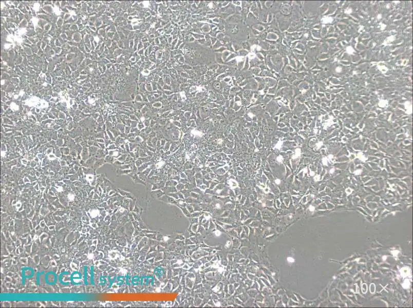 KYSE-140 Cell Complete MediumKYSE-140 Cell Complete Medium - 3