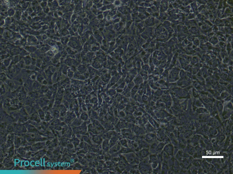 Mouse Pulmonary Microvascular Endothelial (Primary cell immortalization) Cell Complete MediumMouse Pulmonary Microvascular Endothelial (Primary cell immortalization) Cell Complete Medium - 5