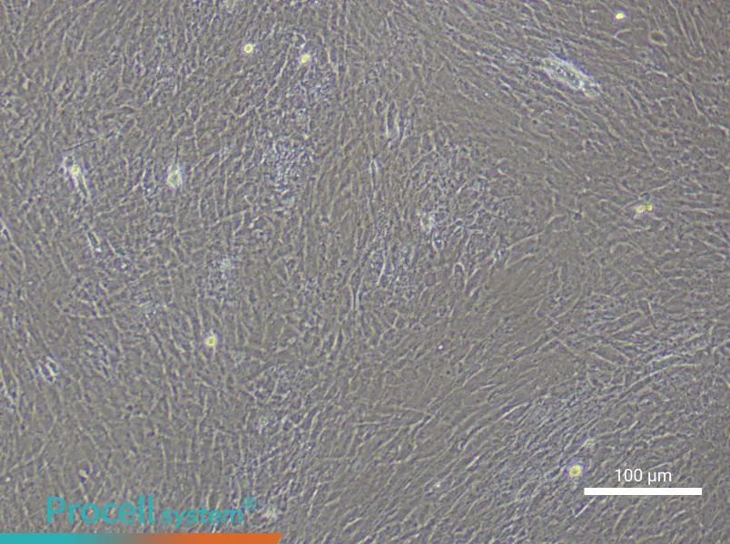 Mouse Mesenteric Smooth Muscle Cell Complete Medium - 1