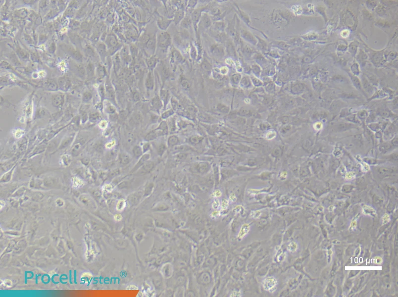 Human Synovial Fibroblast (Primary cell immortalization) Complete MediumHuman Synovial Fibroblast (Primary cell immortalization) Complete Medium - 3