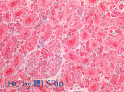 ENO1 Polyclonal Antibody - 4