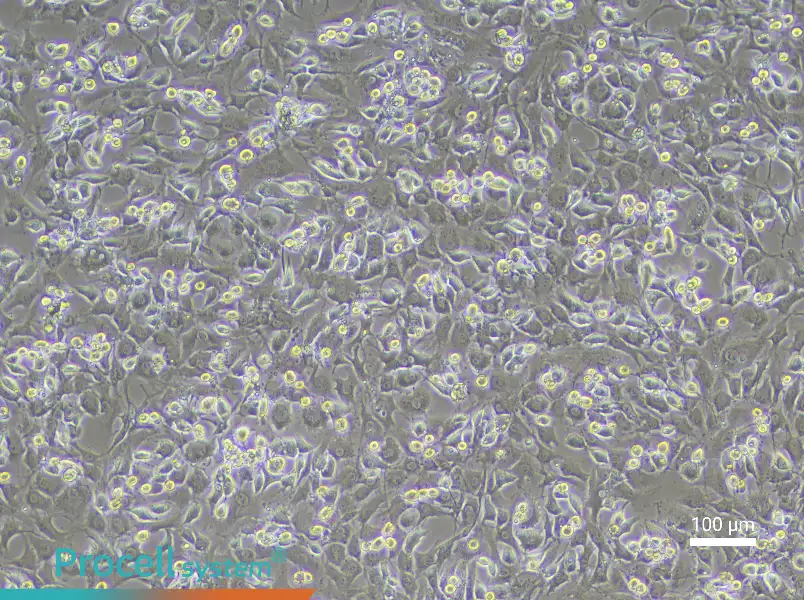 Mouse Intervertebral Disc Annulus Fibrosus Cell Complete Medium - 3