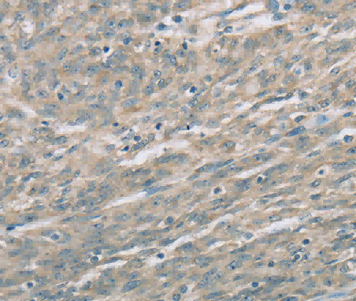 EDA2R Polyclonal Antibody - 2