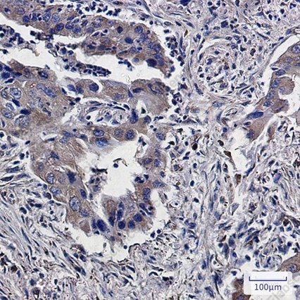 Recombinant Lumican Monoclonal Antibody - 4
