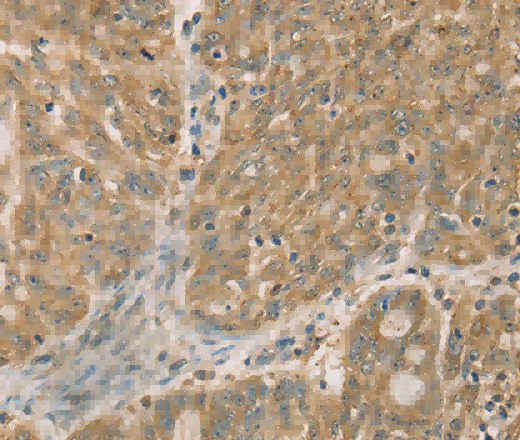 DMRT3 Polyclonal Antibody - 2