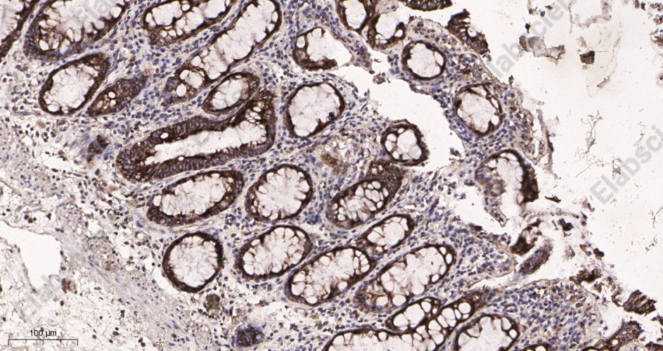 Recombinant ATG5 Monoclonal Antibody - 2