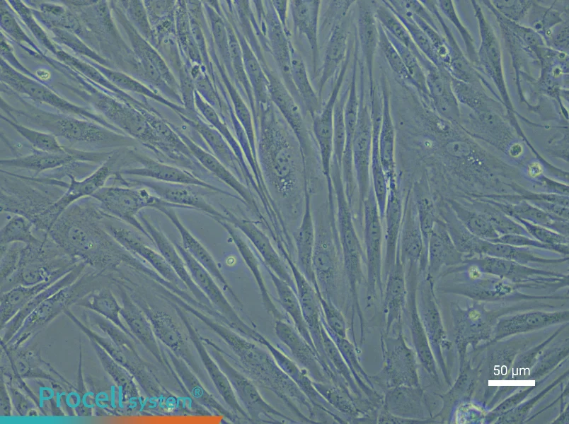 Human Esophageal Smooth Muscle Cell Complete Medium - 5