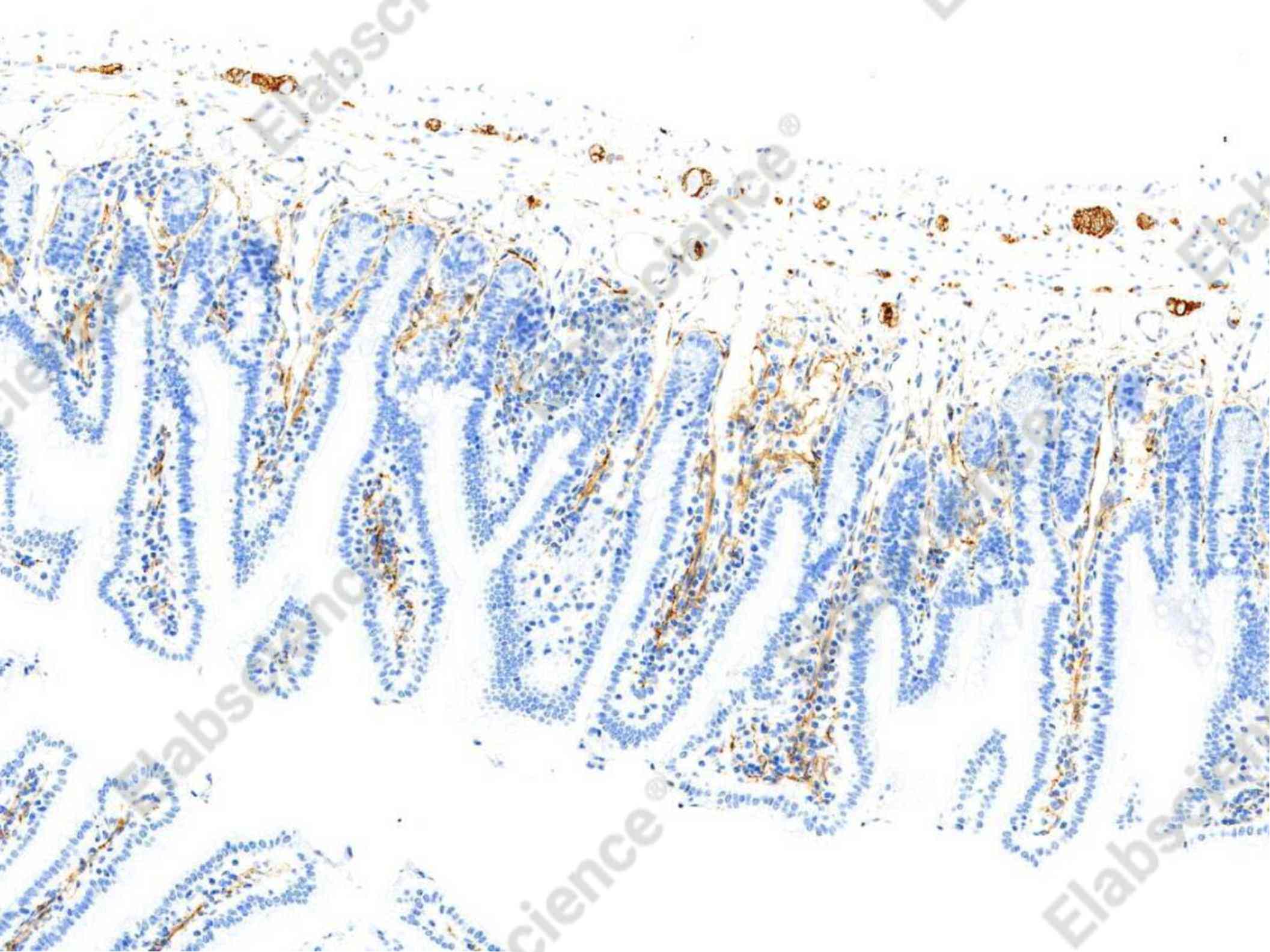 Recombinant NCAM Monoclonal Antibody - 1