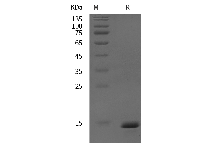 Recombinant Human CXCL5 Protein-产品推荐-1