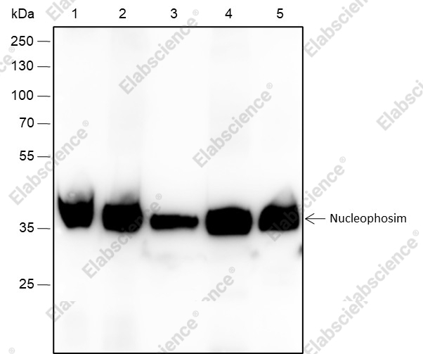 Recombinant NPM1 Monoclonal Antibody - 1