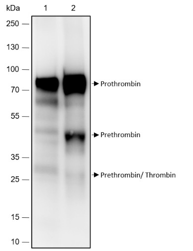 Recombinant Prothrombin Monoclonal Antibody-searchlist-1