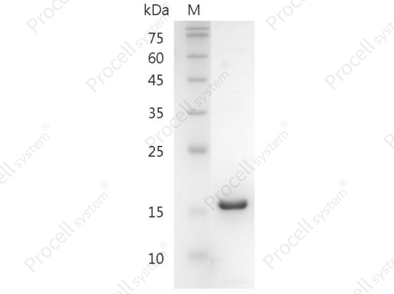 CXCL5/ENA-78, Mouse, Recombinant