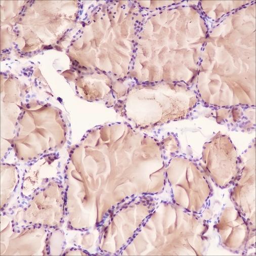 Recombinant Thyroglobulin Monoclonal Antibody - small - 2