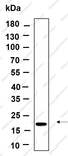 Recombinant Osteocalcin Monoclonal Antibody - 1