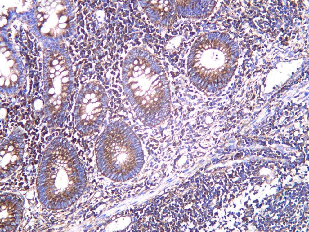 Recombinant Noxa Monoclonal Antibody - 1