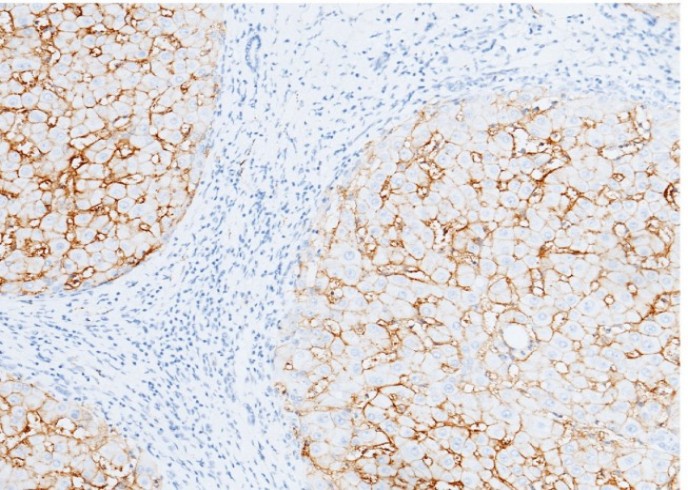 Recombinant Carbonic Anhydrase XIV/CA14 Monoclonal Antibody - small - 2