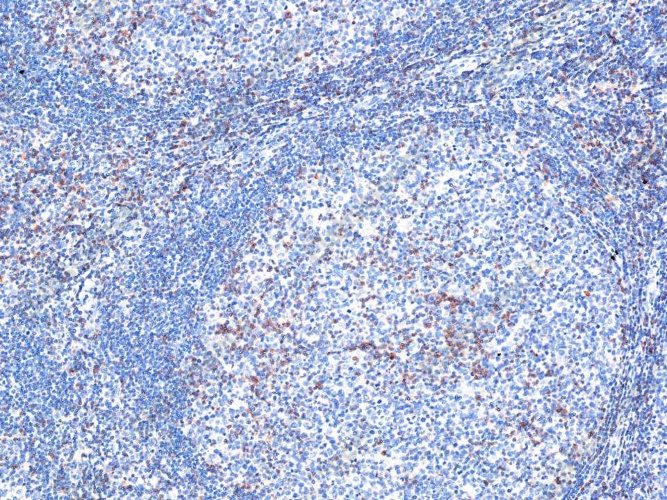 Recombinant CD27/TNFRSF7 Monoclonal Antibody - 1
