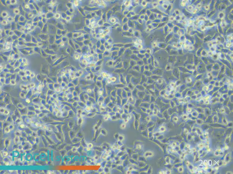 TOV-21G Cell Complete Medium - small - 5