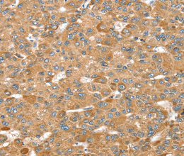 MORF4L1 Polyclonal Antibody - 2