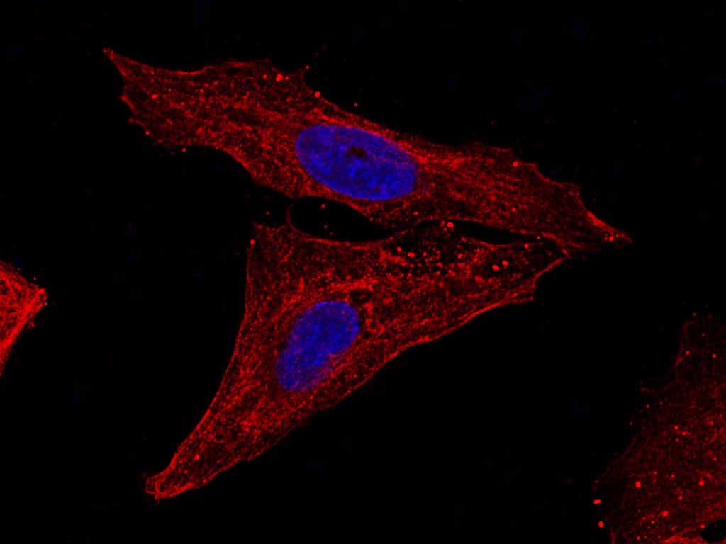 Purified Anti-Human CD25 Antibody[7G7B6]-产品推荐-1
