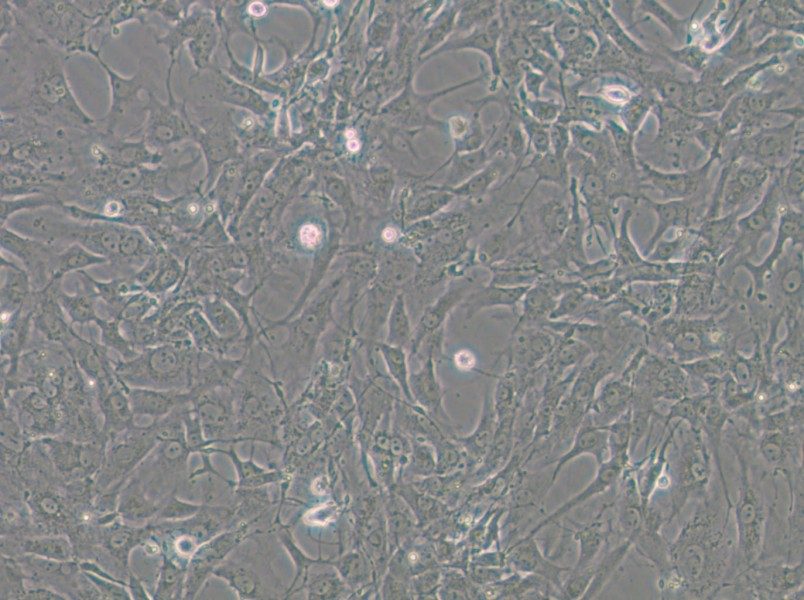 Tb 1 Lu Cell Complete Medium - small - 4