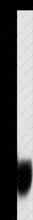 GPM6A Polyclonal Antibody - 1
