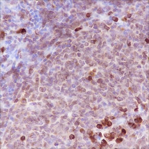 Recombinant CD79a Monoclonal Antibody - 3