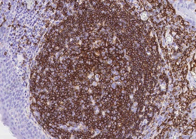 CD20/MS4A1 Monoclonal Antibody - 2