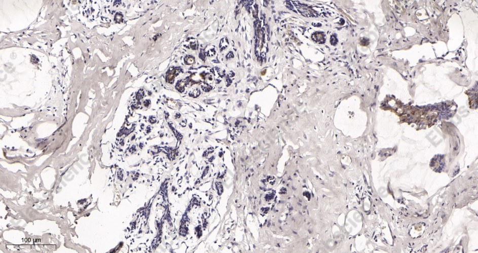 Recombinant Phospho-GSK3 β (Ser9) Monoclonal Antibody - 2