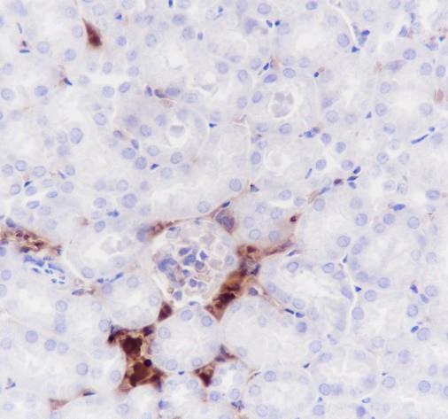 Recombinant Hemoglobin Alpha Monoclonal Antibody - small - 3
