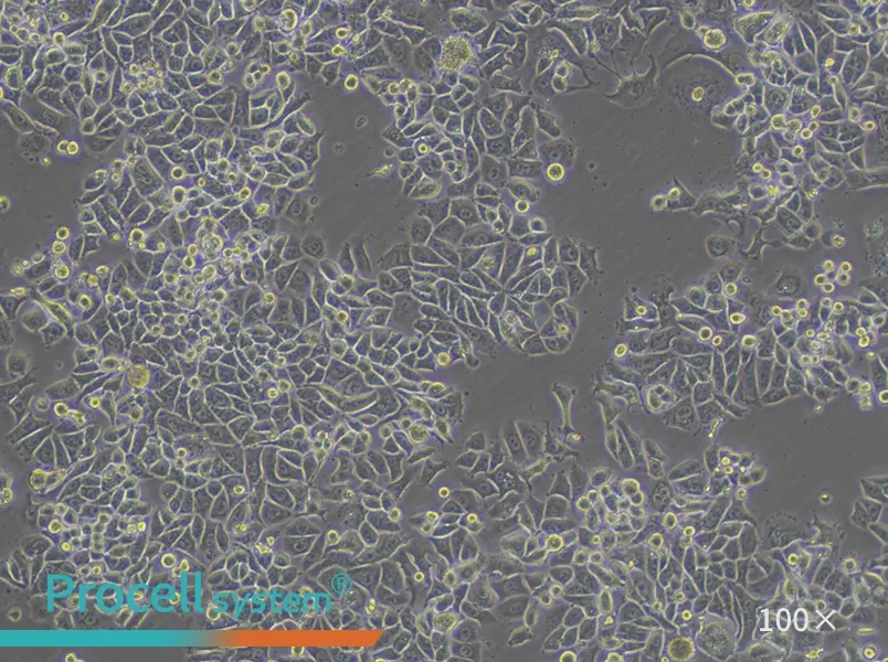 SK-BR-3 [SKBR3] Cell Complete Medium - 2