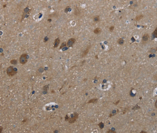 GSTA3 Polyclonal Antibody - 2