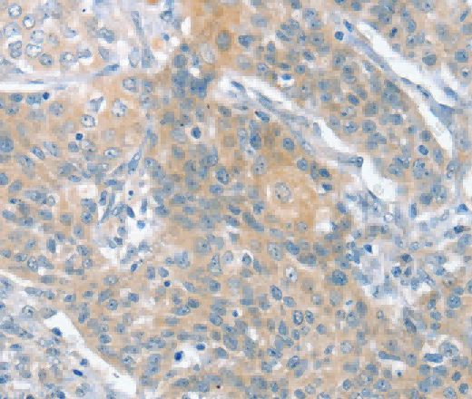 SLIT2 Polyclonal Antibody - 3