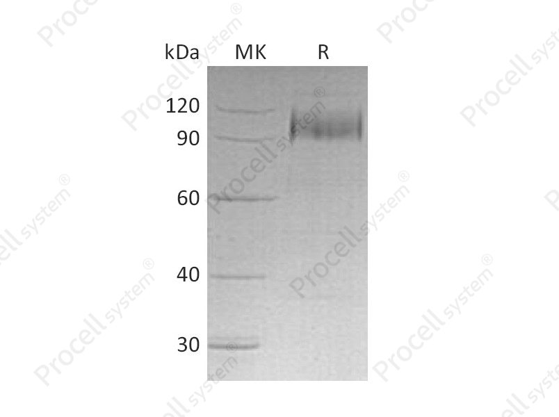 EGFR/ErbB1/HER1 (C-6His), Human, Recombinant