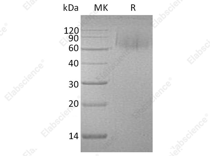 Recombinant Human MERTK/MER Protein (His Tag) - 1