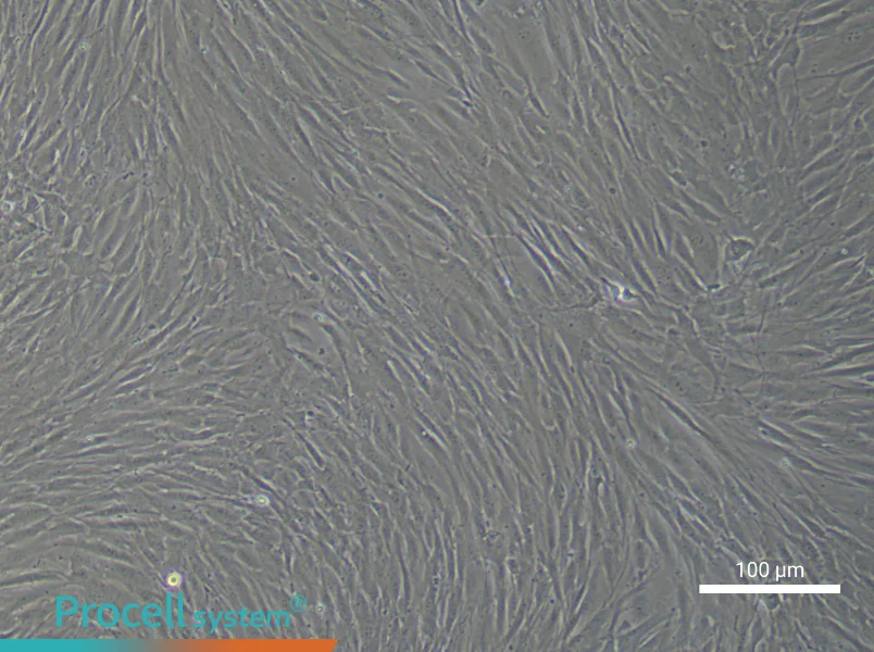 Human Bronchial Smooth Muscle Cell Complete Medium - 2