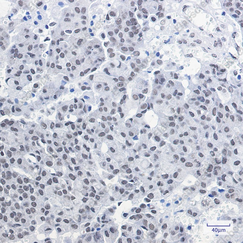 Recombinant CGBP Monoclonal Antibody - 3