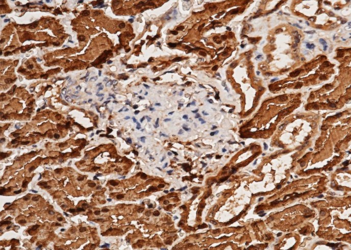 Recombinant ACY1/Aminoacylase-1 Monoclonal Antibody-searchlist-1
