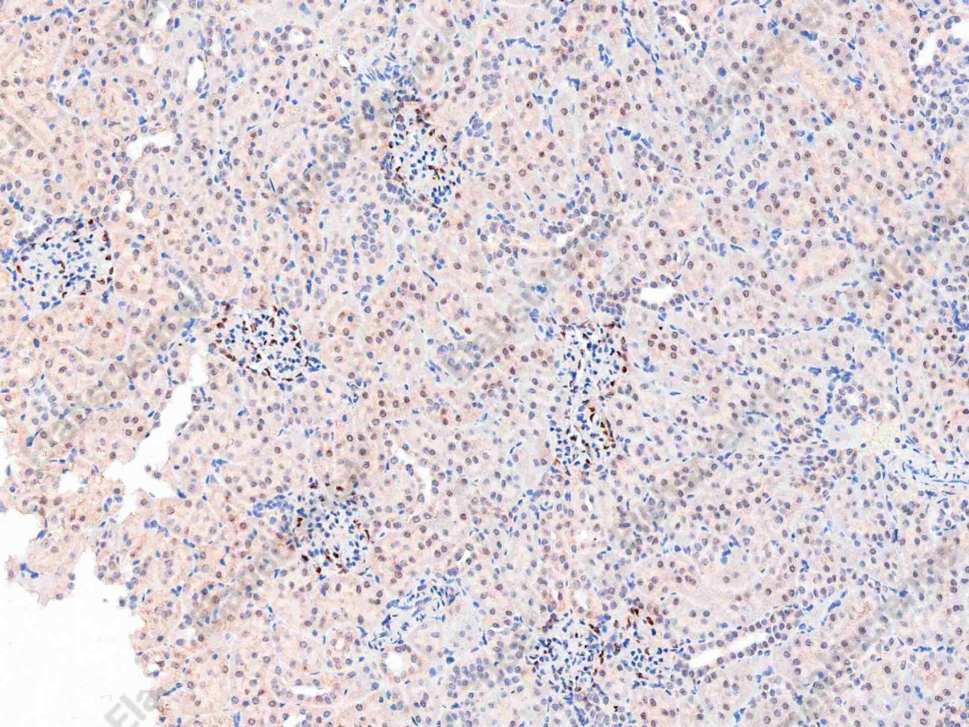 Recombinant p38 Monoclonal Antibody - 1