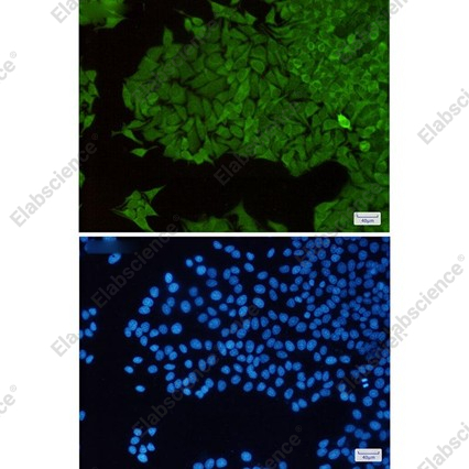 Recombinant TXNRD1 Monoclonal Antibody - 3