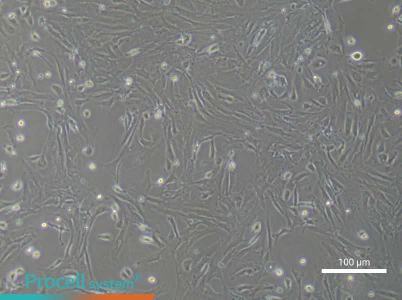 Mouse Intestinal Fibroblast Complete MediumMouse Intestinal Fibroblast Complete Medium - 2