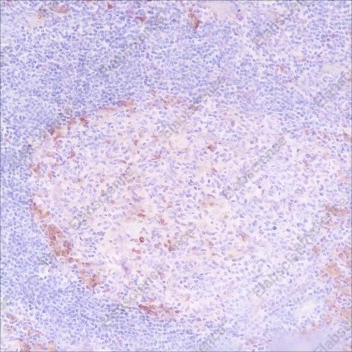 Recombinant VPAC1 Monoclonal Antibody - 2