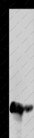 CSH1 Polyclonal Antibody - 1